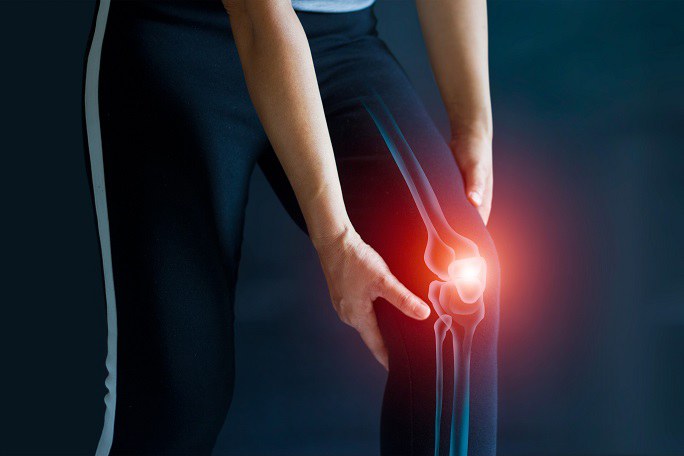 Eine Frau in einer Sporthose hält sich das Knie. Man sieht eine computergenerierte Darstellung der Knochen und des Kniegelenks der Frau, welches hell rötlich leuchtet, was auf Schmerzen schließen lässt.