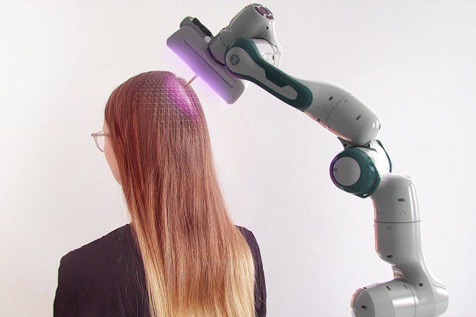 Hinterkopf einer Frau, über dem ein Roboterarm zu sehen ist, der den Hinterkopf beleuchtet und mit einem länglichen Instrument berührt.