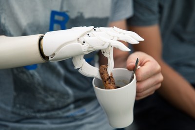 Eine im 3D-Druck-Verfahren hergestellte Handprothese